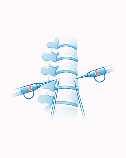 Surgical Care