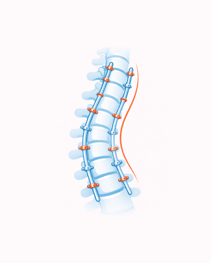 Spine Care