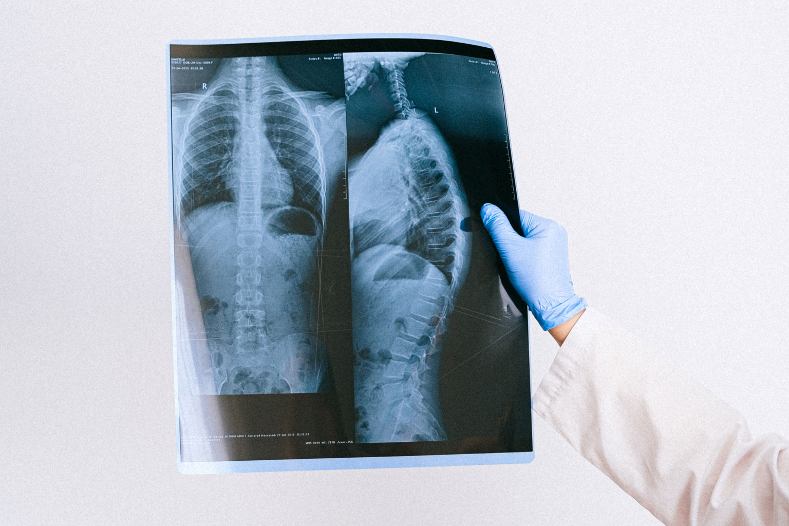 Advanced endoscopic spine expertise